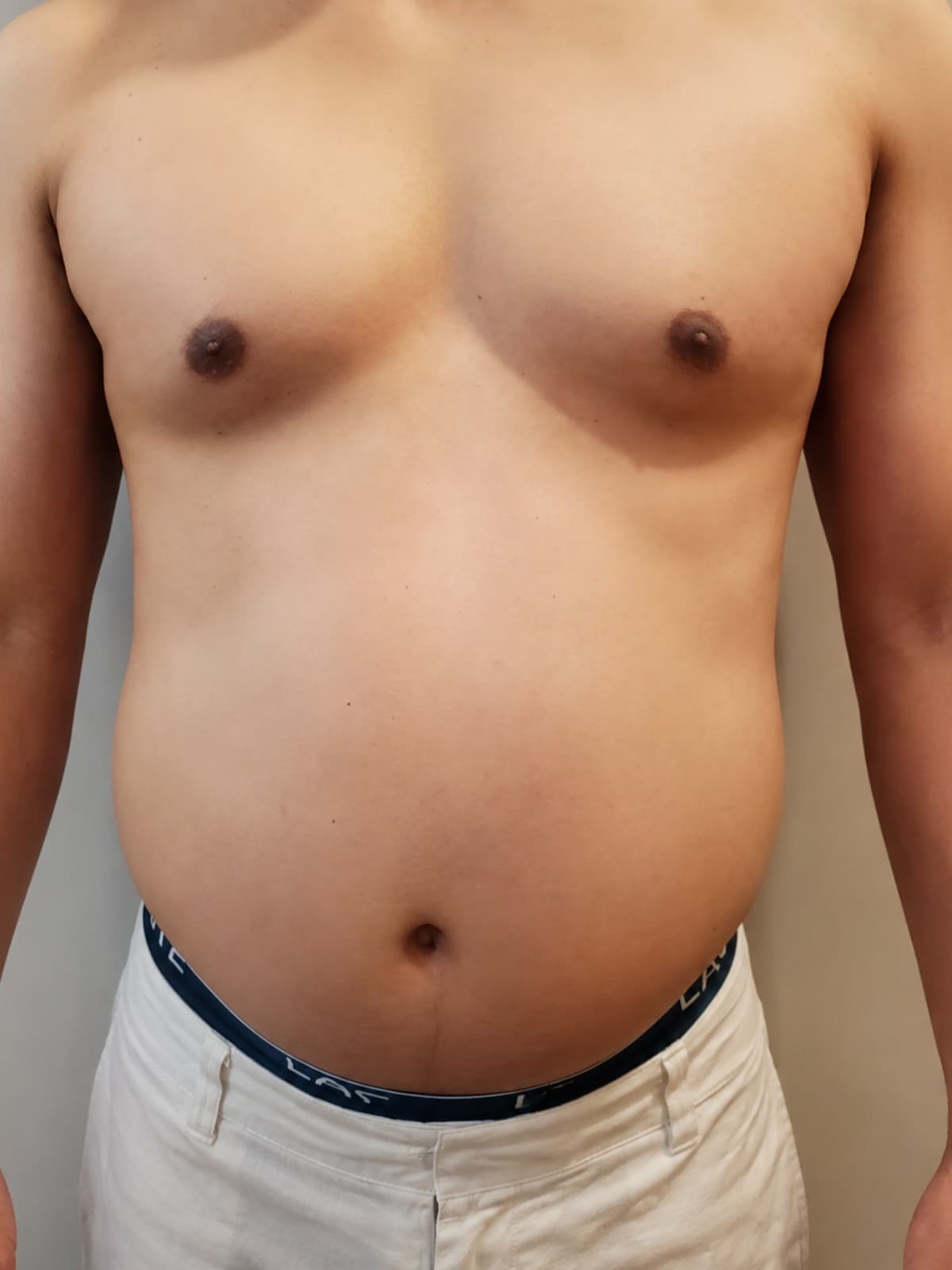Founder Tiger — Before, Day 1